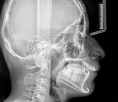 telerradiografia